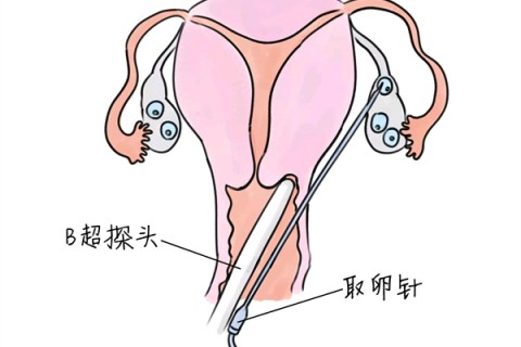 http://nanjing.vdtfzz.com/post/205.html|南京供卵助孕
