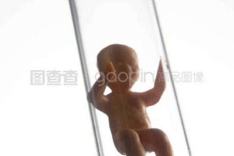 http://nanjing.vdtfzz.com/post/197.html|南京试管助孕